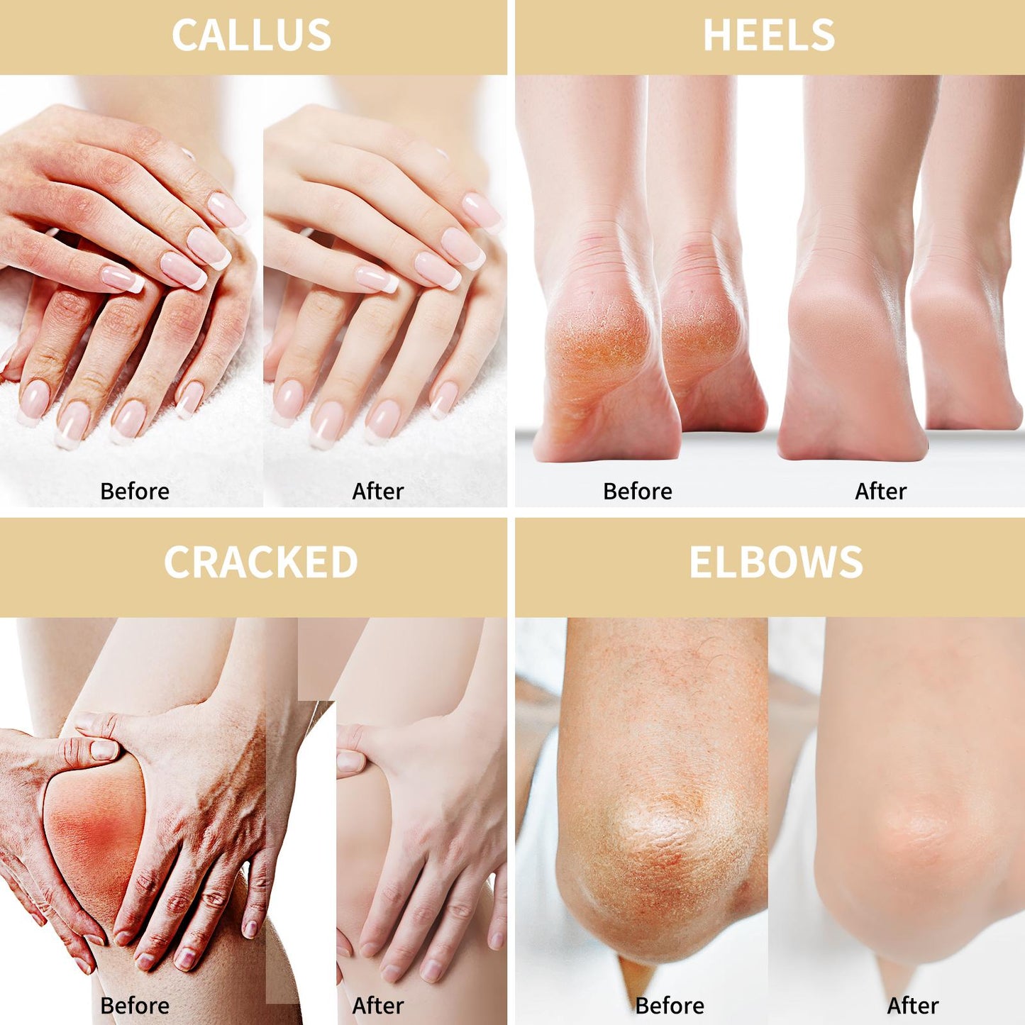 Grocerism 50% Urea Cream with Oat Extract for Sensitive Skin | Foot & Hand Cream with 2% Salicylic Acid, Hyaluronic Acid, Tea Tree & Aloe Vera,for Deep Hydration, Callus Removal, Beneficial for Cracked Heels and Hands 5.29 oz