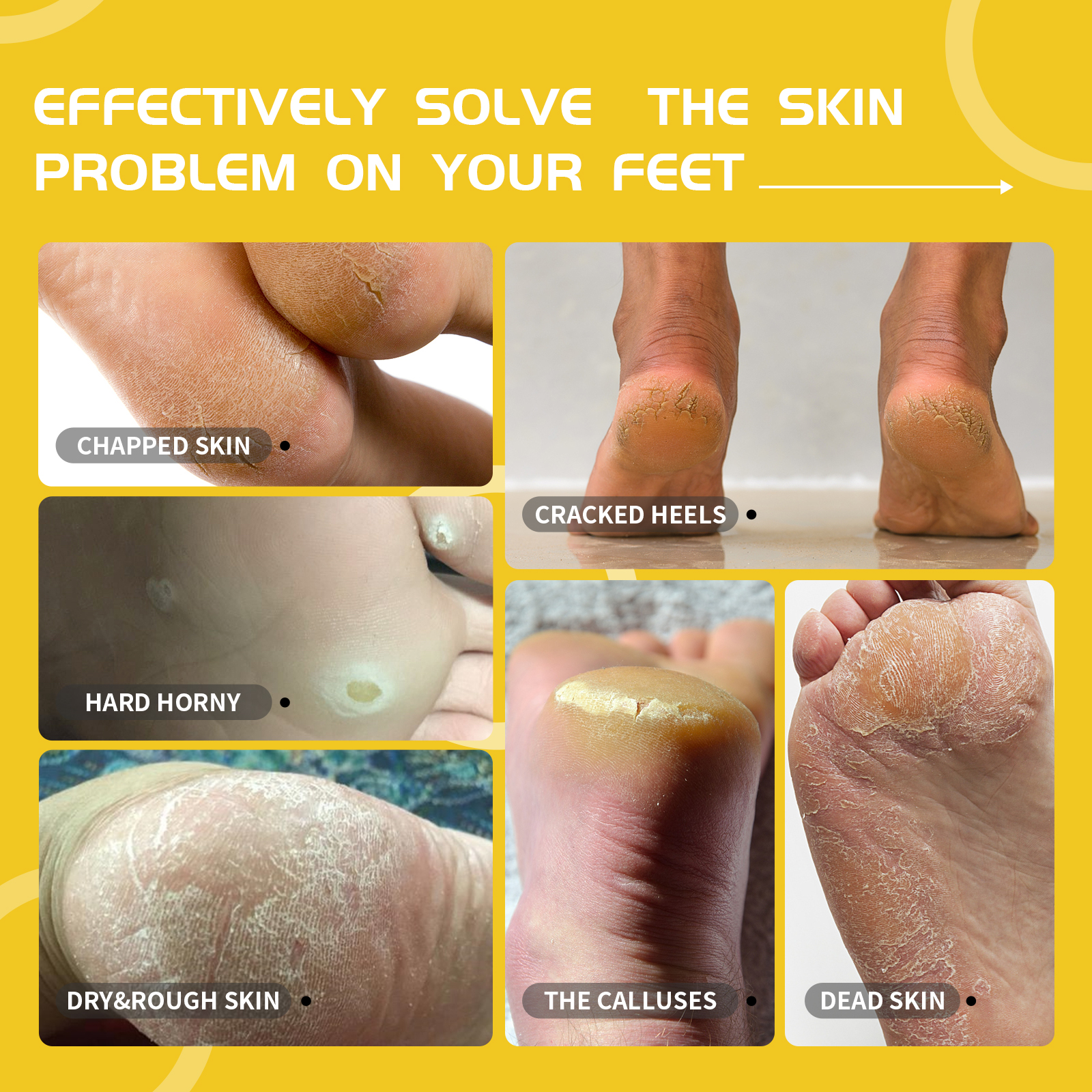 Lee Beauty Professional Foot Callus Remover: $15, Melts Away Dead